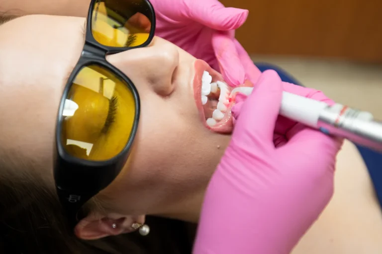 Periodontal Maintenance